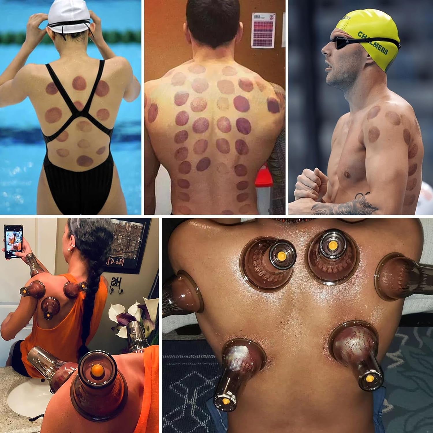 Cupping Set - Cupping Kit for Massage Therapy W/ 12 Cupping Therapy Set for Pain Relief Physical Therapy Body Vacuum Massage Cups with Pump